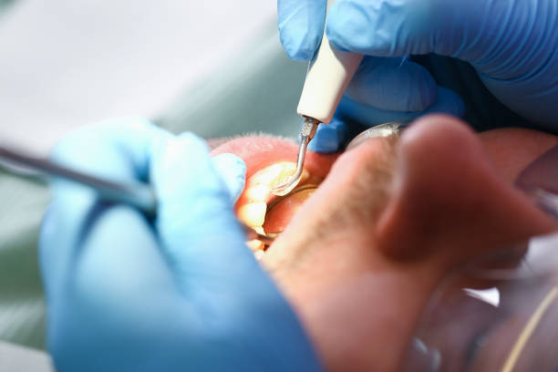 Best Emergency Treatment for Toothache in Marshallville, GA